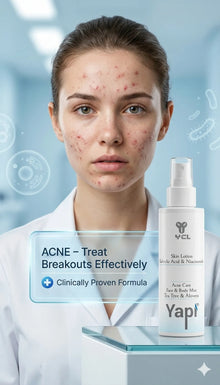 Yapi Acne Care Face & Body Mist